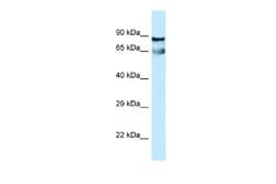 CEP76 Antibody, Novus Biologicals 100 &mu;L; Unconjugated:Antibodies, Polyclonal